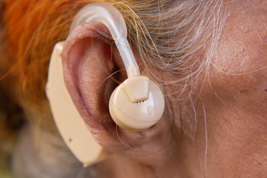 Hearing aid concept, a senior women with hearing problems. photo