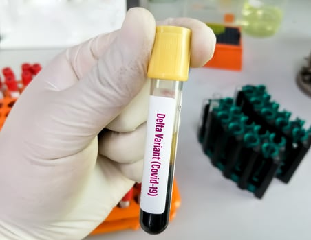 Technician holding tube of blood test identified with the label Covid-19 DELTA Variant. Doctor with a positive blood sample for the new variant detected of the coronavirus strain called DELTA photo