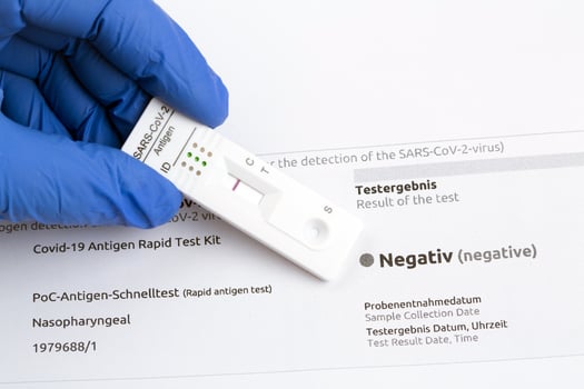 Negative test result by using rapid test device for COVID-19. photo