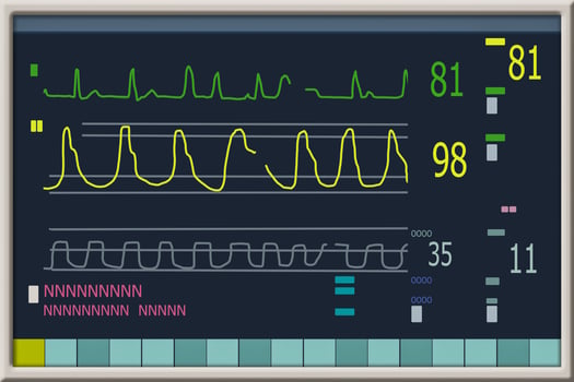 Patient monitor showing vital signs ECG and EKG. Vector illustration. photo
