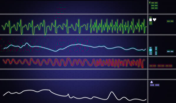 Patient monitor showing vital signs ECG and EKG. Vector illustration. photo