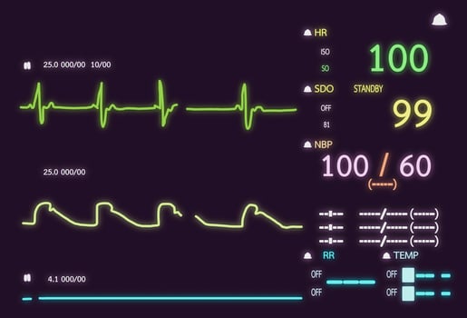 Patient monitor showing vital signs ECG and EKG. Vector illustration. photo