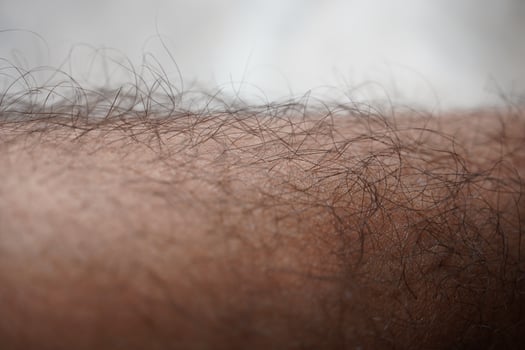 hair on a man's lag photo