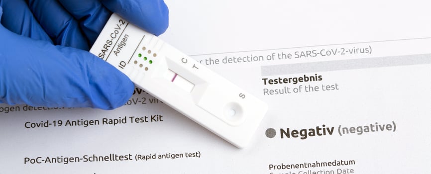 Negative test result by using rapid test device for COVID-19. photo