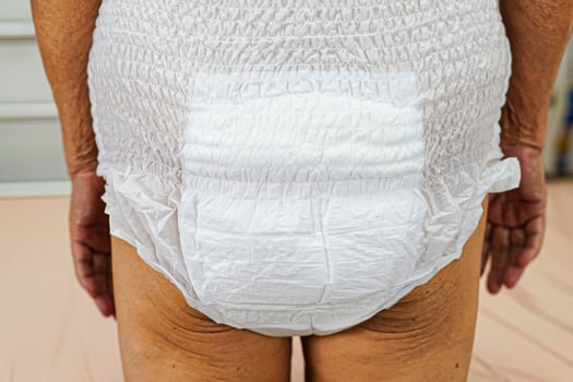 Asian elder senior woman patient wearing adult incontinence diaper pad in hospital. photo