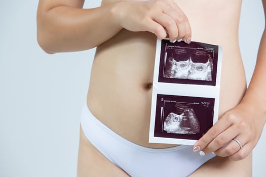 pregnant woman holding ultrasound image concept of pregnancy photo