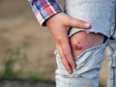 the girl holds her hand over the wounded leg photo
