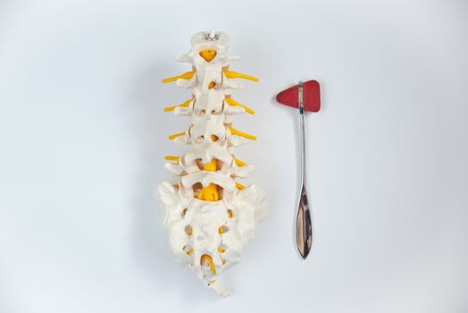 Top view of lumbar spine model and reflex hammer. photo