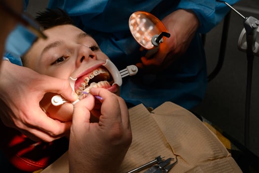 The teenager has braces glued to his upper teeth to straighten them, and the boy has a retractor on his lips. photo