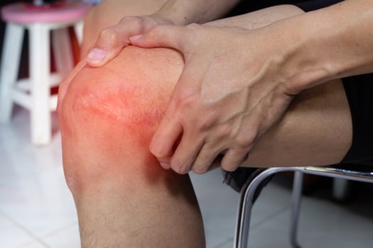 Man puts hands on knee in pain from surgery wound photo