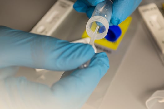 COVID-19 rapid test performed in hospital lab with background of viral tests photo