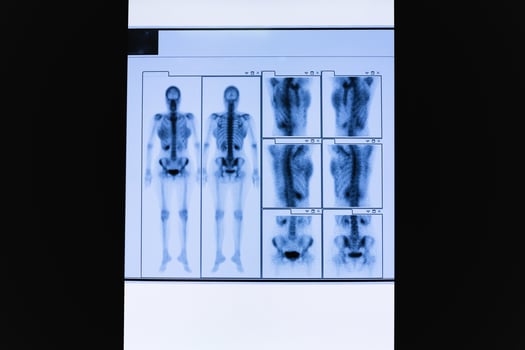 Set of TC scan of female whole body skeleton and internal organs. photo