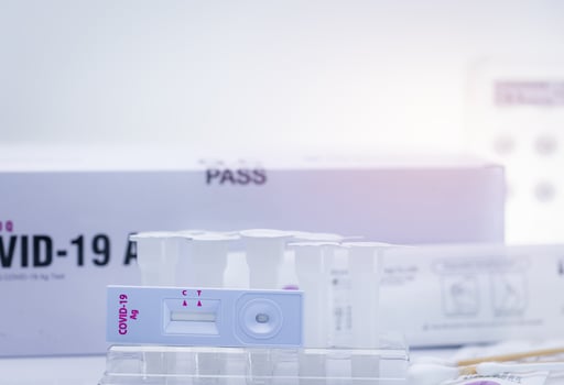 Covid 19 antigen self test for nasal swab. Antigen test kit for home use to detection coronavirus infection. Rapid antigen test. Corona virus diagnosis. Medical device for covid-19 antigen test. photo