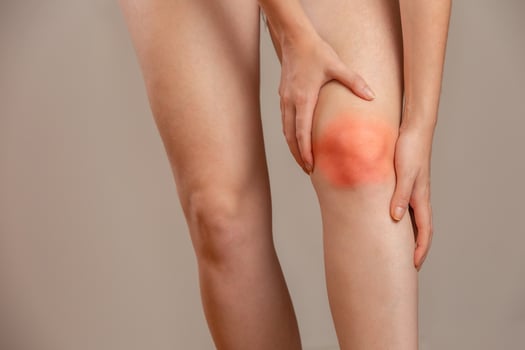 Bone pain or knees around the knee. The girl's hand is holding the knee area. Redhead woman. photo