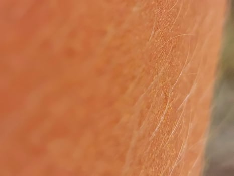 Close up of white caucasian skin with hair. photo