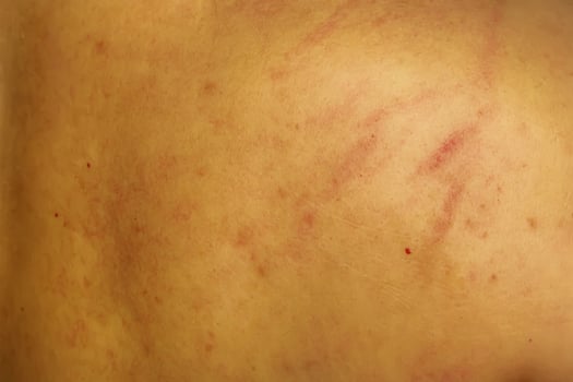 Wound was caused by scratches photo