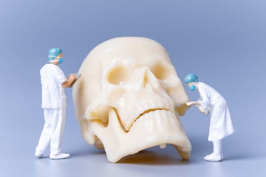 Miniature people Doctor with a giant human skull on a grey background photo