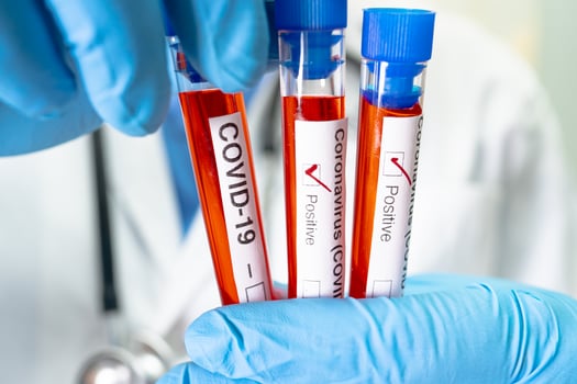 Positive blood infection sample in test tube for covid-19 coronavirus in lab. Scientist holding to check and analyze for patient in hospital. photo