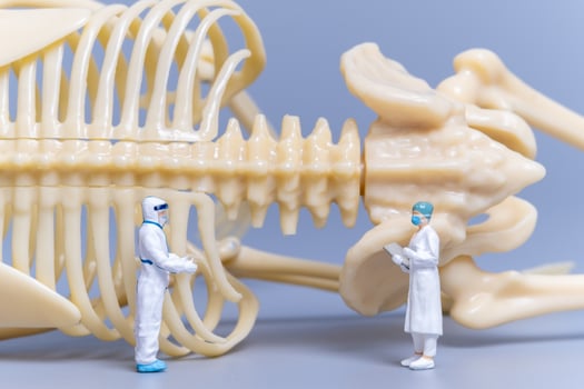Miniature people Doctor with a giant human bone on a grey background photo