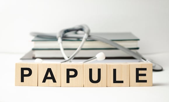 papule on wooden cubes and stethoscope. Medical concept photo