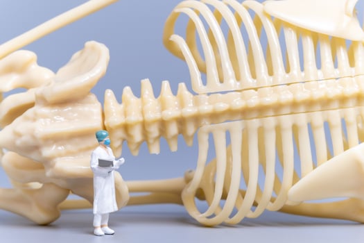 Miniature people Doctor with a giant human bone on a grey background photo