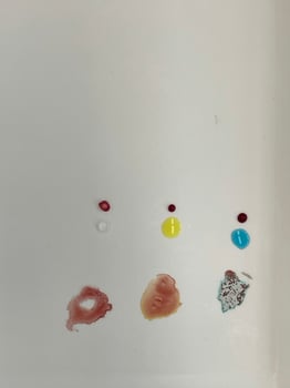 Blood test view photo