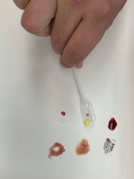 Blood test view photo