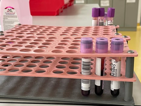 Blood vial view photo