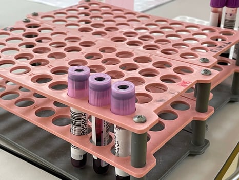 Blood vials view photo