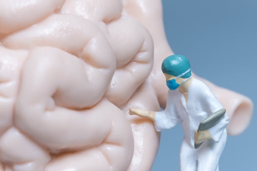 Miniature people Doctor examining The gastrointestinal tract photo