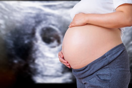 Pregnant Woman with ultrasound equipment background photo