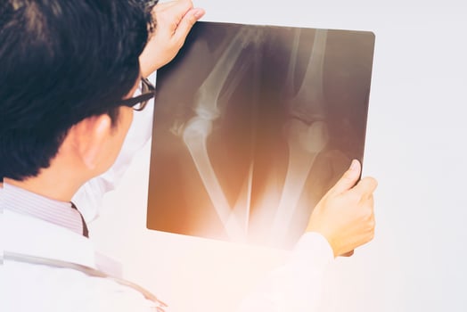 Warm tone photo of male doctor is examined x-ray film