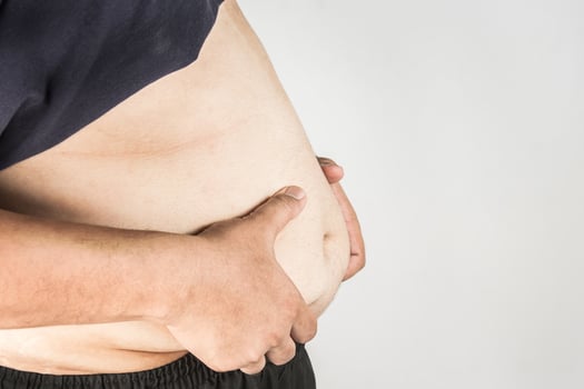 Overweight man body with hands touching belly fat photo