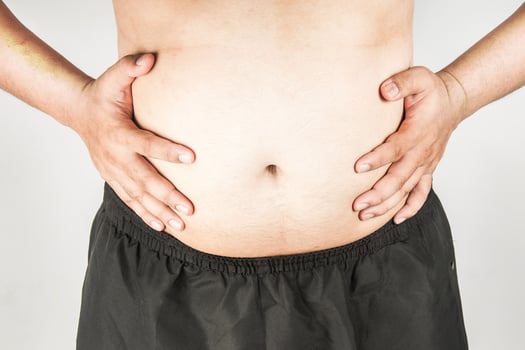 Overweight man body with hands touching belly fat photo