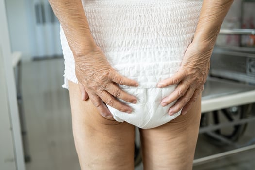 Asian senior or elderly old lady woman patient wearing incontinence diaper in nursing hospital ward, healthy strong medical concept. photo