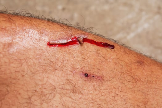man injured. Close-up wound on  leg.health care concept photo