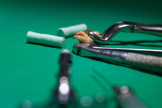 a pulled tooth at the dentist photo