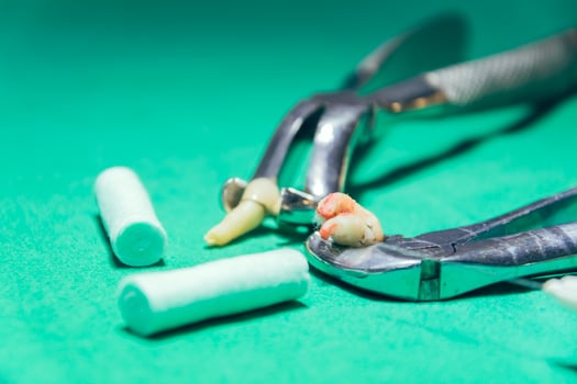 extract a tooth photo