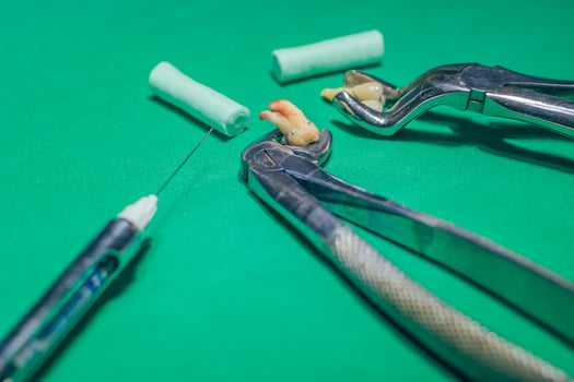 extract a tooth photo
