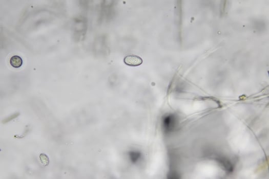 Penicillium, ascomycetous fungi are of major importance in the natural environment as well as food and drug production. photo