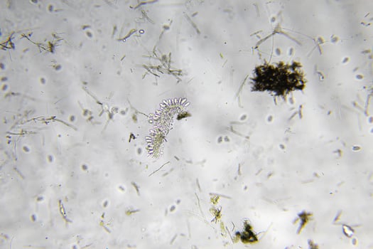 Penicillium, ascomycetous fungi are of major importance in the natural environment as well as food and drug production. photo
