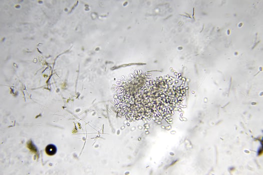 Penicillium, ascomycetous fungi are of major importance in the natural environment as well as food and drug production. photo
