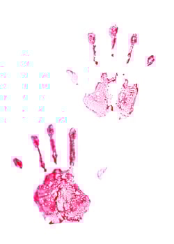 Blood stains isolated on white background photo