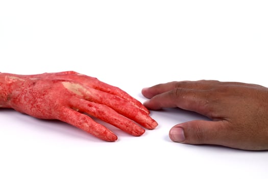 Bloody hand Concept Halloween photo