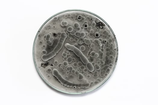 close up of  biochemistry research test fungus growing petri dish in lab. photo