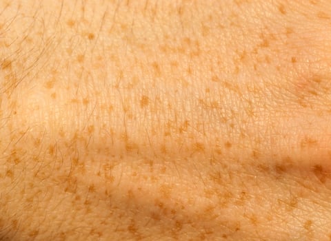 skin of the human hand photo