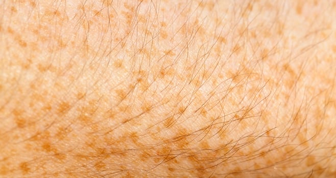 skin of the human hand photo