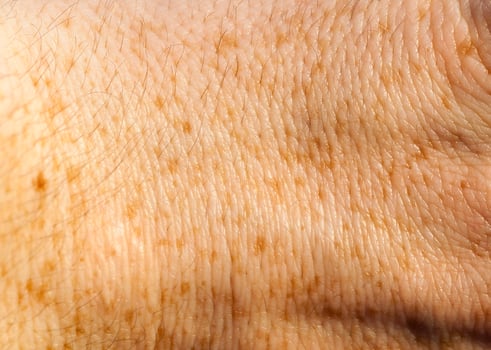 skin of the human hand photo