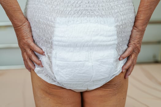 Asian elder senior woman patient wearing adult incontinence diaper pad in hospital. photo