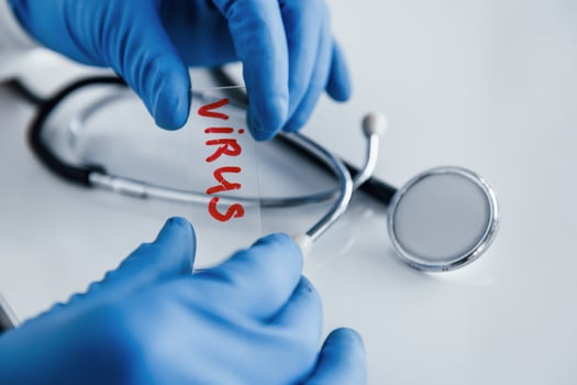 Close up view of scientist in gloves holds glass with virus word on it photo